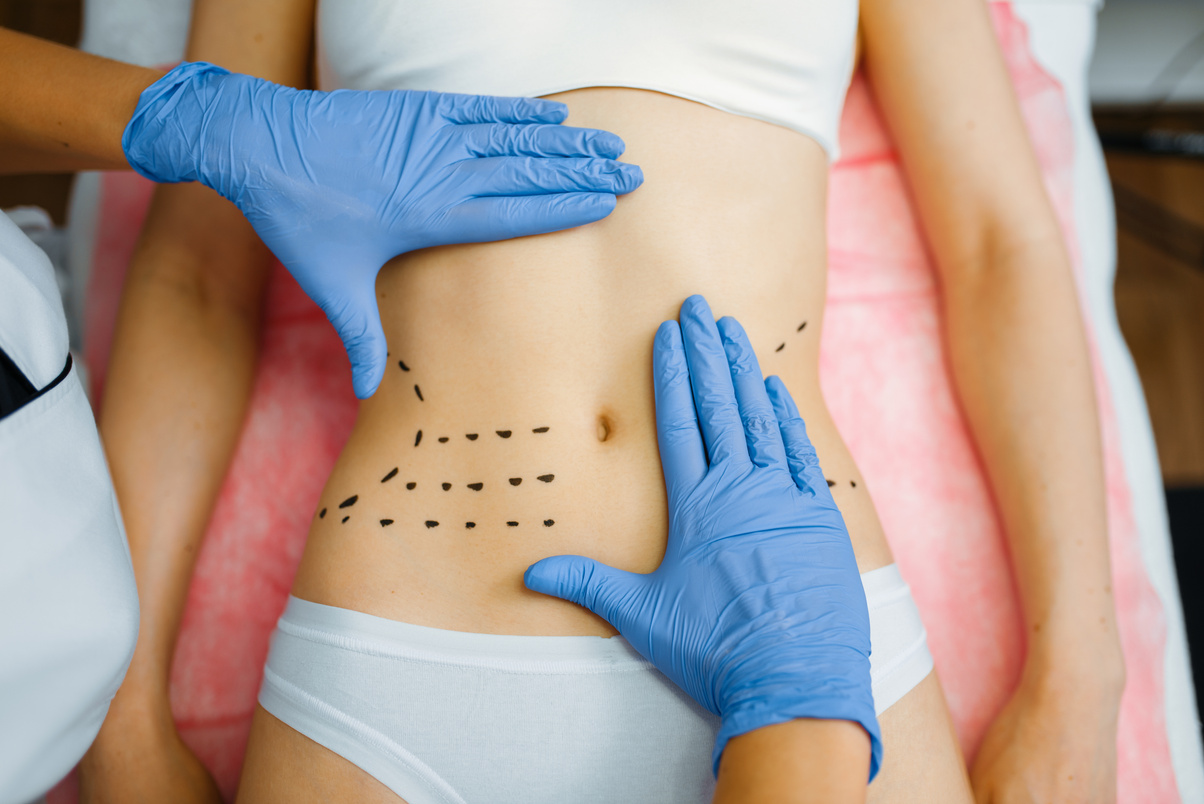 Cosmetician's Hands on Female Patient Abdomen